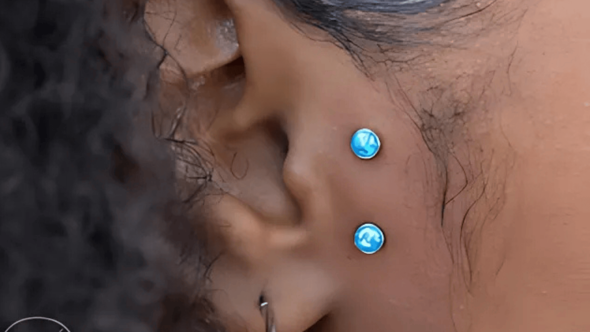 Surface Tragus piercing