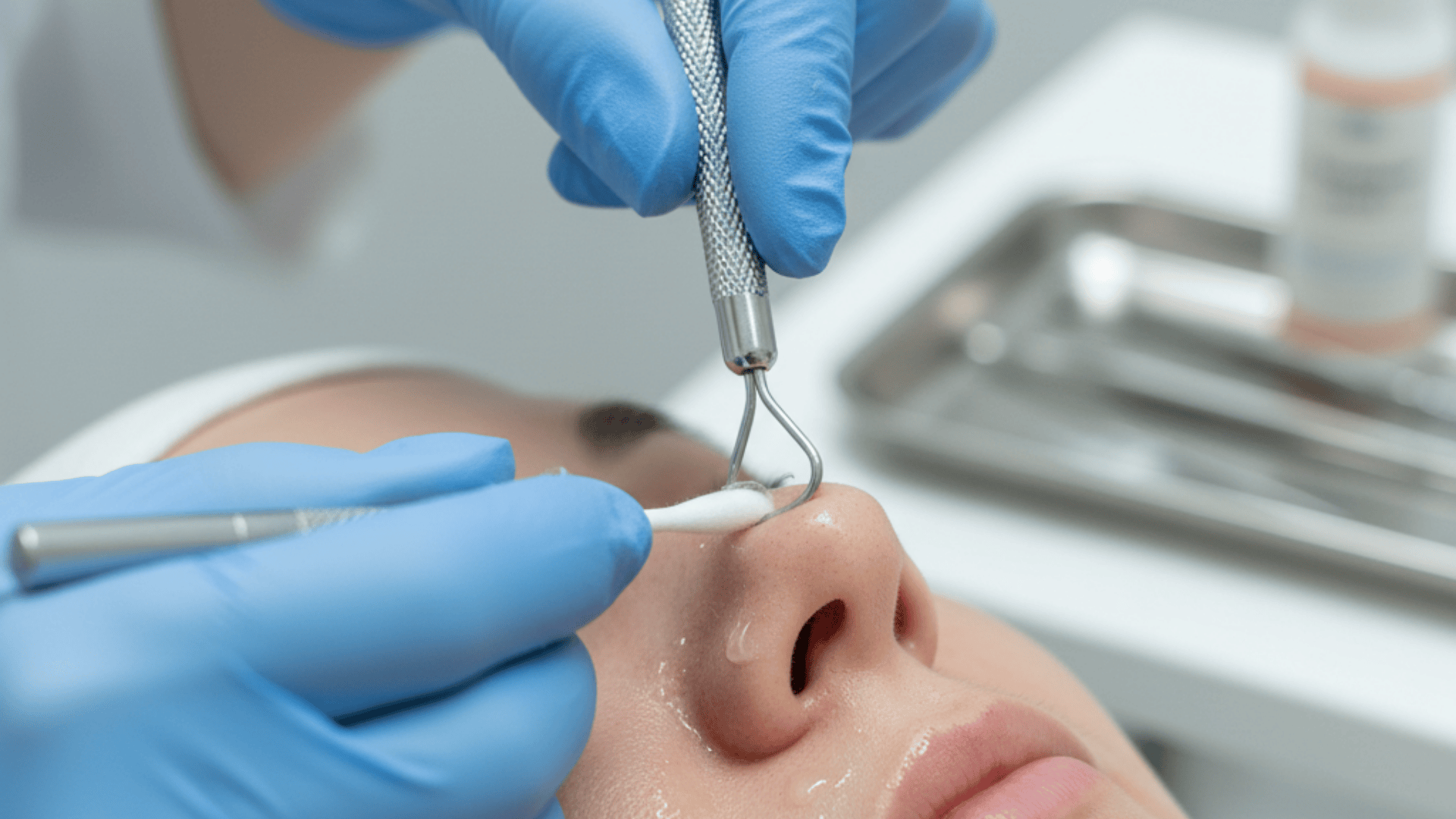 blackhead extraction