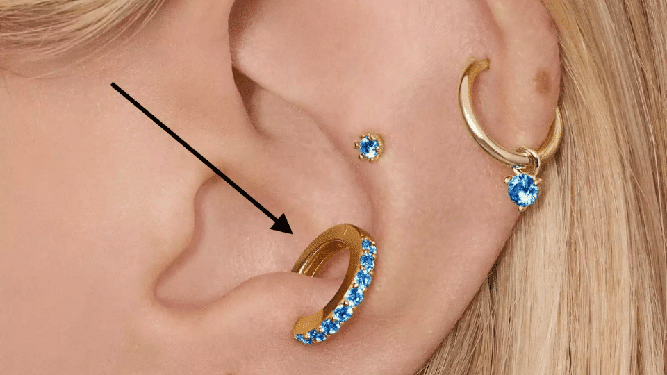 Anti- Tragus