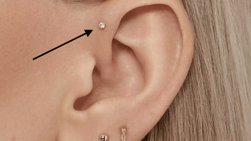Forward Helix