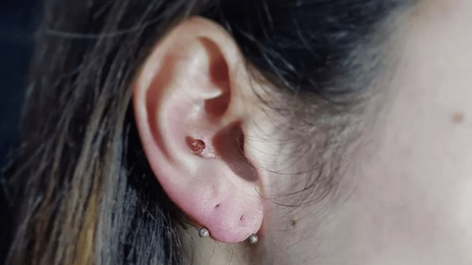 Transverse Lobe