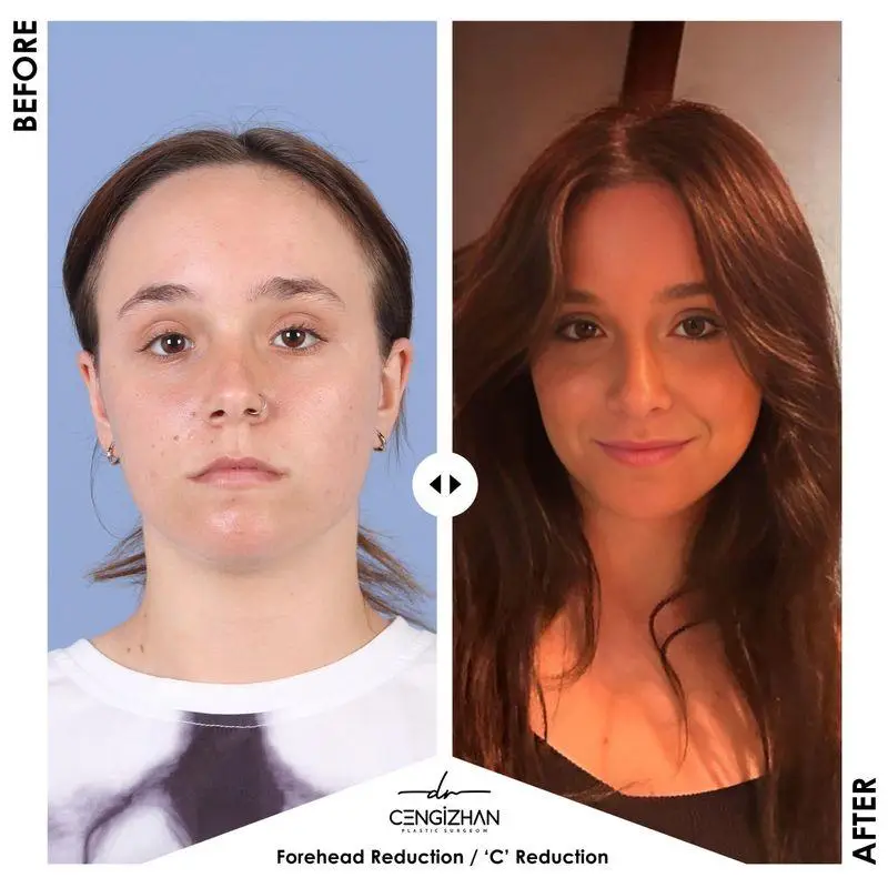 Before and after comparison of woman with different hairstyles in studio lighting