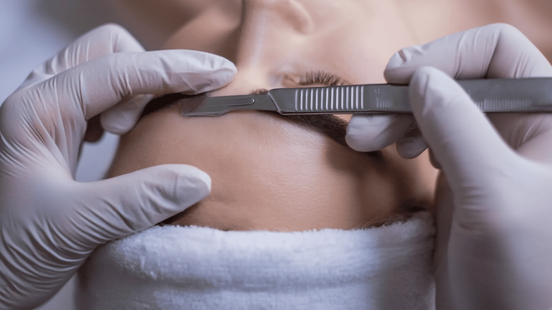 Woman receiving facial dermaplaning treatment with a handheld exfoliating skincare device.