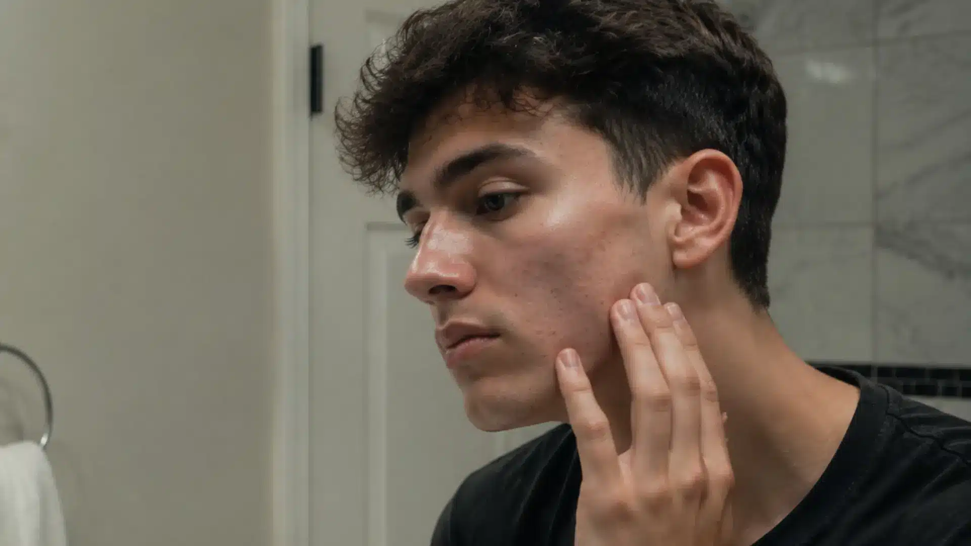a young man looks in a mirror and touches his acne-prone cheek