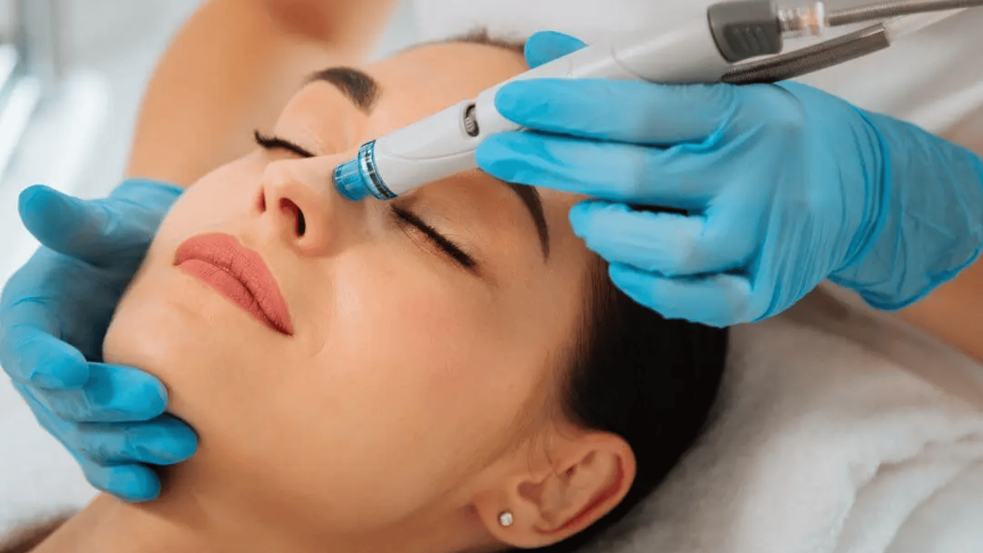 Close-up of facial laser hair removal treatment on a woman’s nose at a skincare clinic.